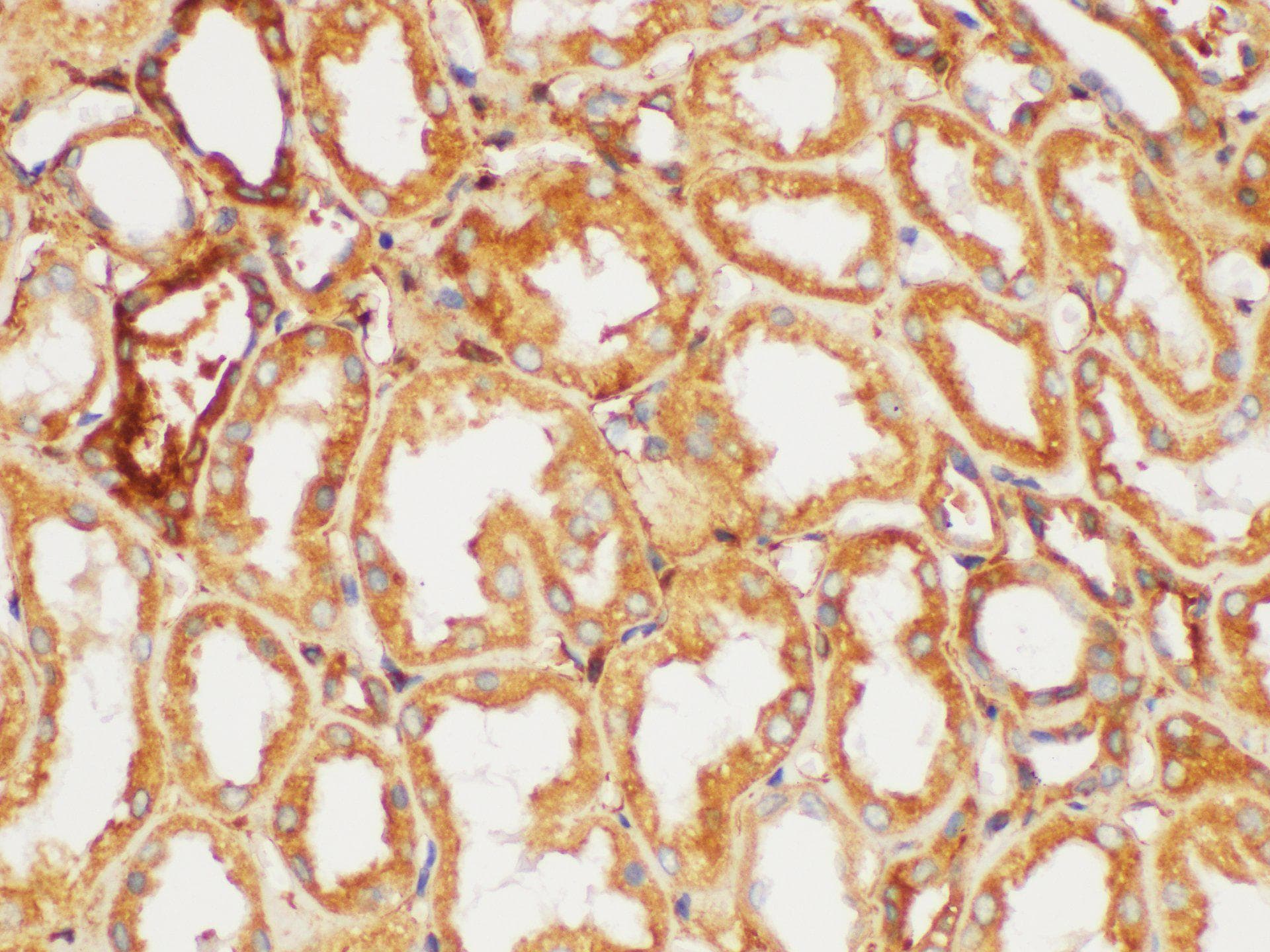 FGB / Fibrinogen Beta Chain Antibody