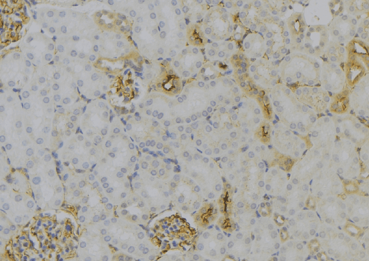 MT-ND6 Antibody