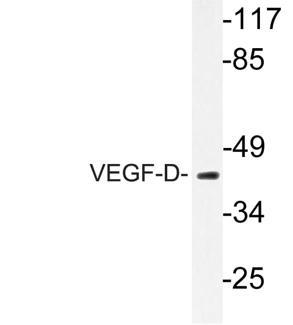 VEGFD Antibody (Ile202)