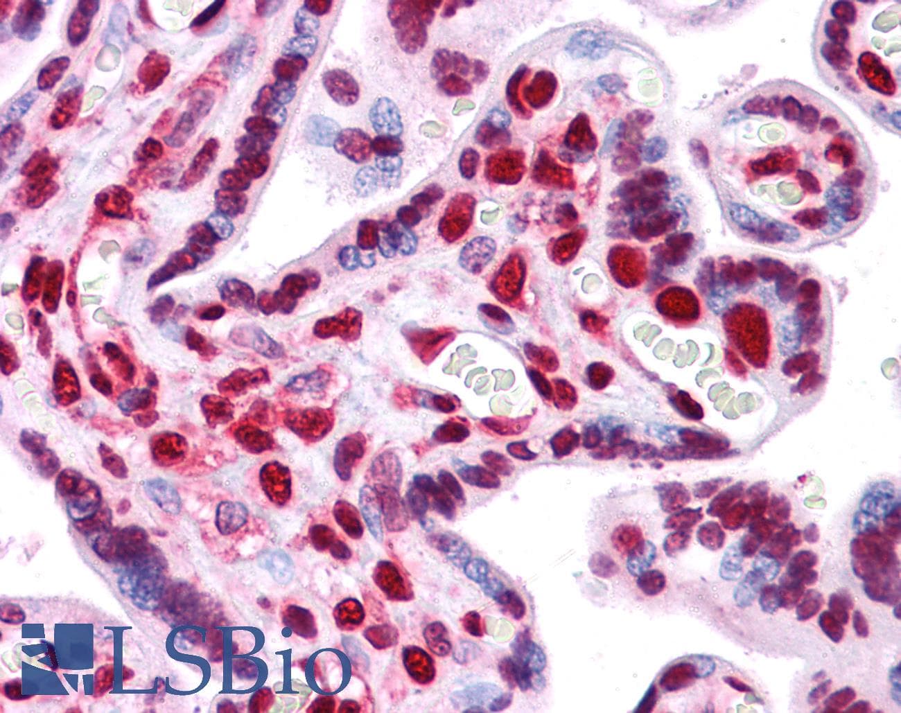 IHC-plus™ HMG1 / HMGB1 Antibody (clone 2F6)