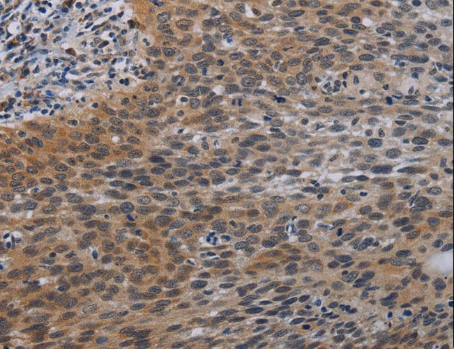 I-309 / CCL1 Antibody