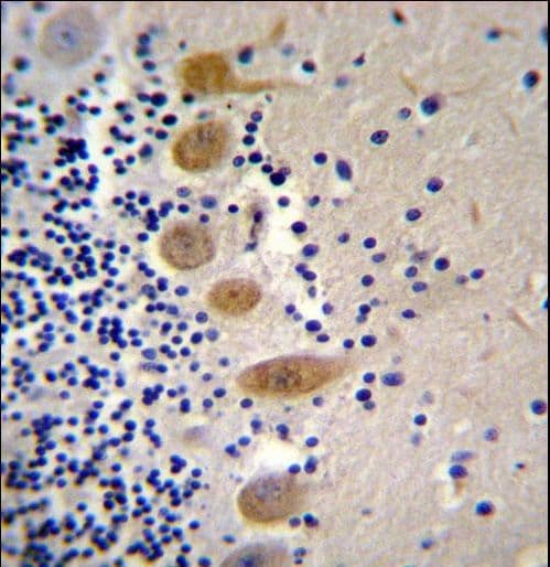 Polyclonal Rabbit anti-Human MST1 Antibody (aa454-483, IHC, WB)