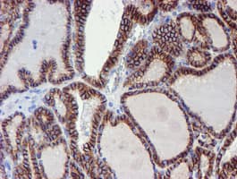 ERBB2 / HER2 Antibody (aa676-1255, clone OTI11A7, Carrier-free)