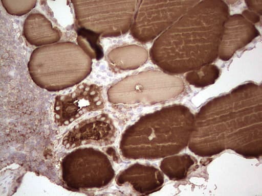 TG / Thyroglobulin Antibody (aa20-358, clone OTI8F7)