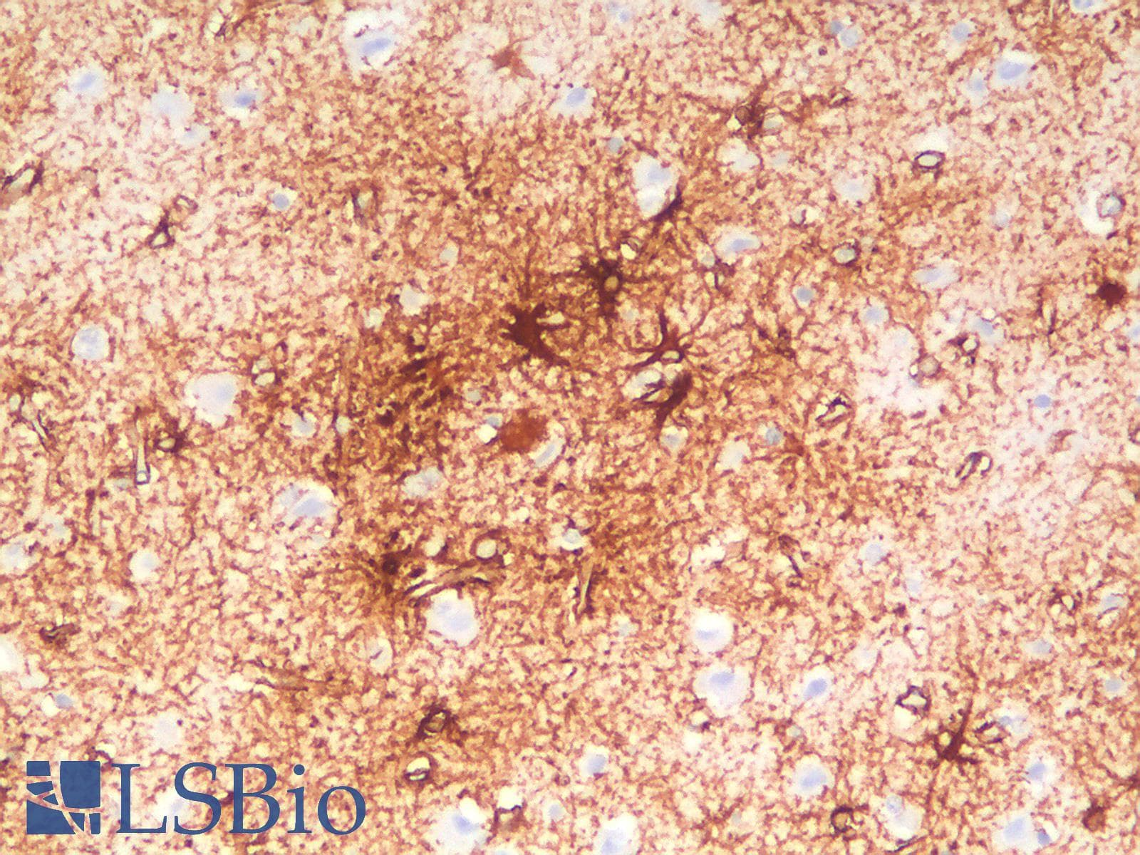 PathPlus™ GFAP Antibody (clone ASTRO/1974R)