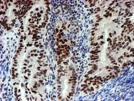 SNAI2 / SLUG Antibody (clone OTI1A6)