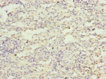 Polyclonal Rabbit anti-Human FBXL5 / FBL5 Antibody (IHC)