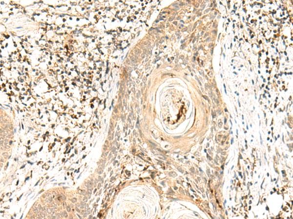 POLR1E Antibody