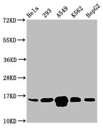 Polyclonal Rabbit anti-Human HIST1H3A Antibody (IHC, WB)