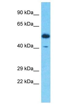 SERPINB3 Antibody (aa271-320)