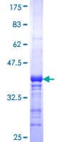 Human SCAMP3 Protein (Recombinant GST, N-terminus)