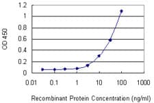 Monoclonal Mouse anti-Human ITGAM / CD11b Antibody (clone 4E10)