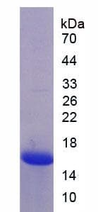 Human MASP2 / MASP-2 Protein (Recombinant His)