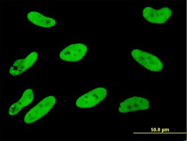 IHC-plus™ Monoclonal Mouse anti-Human SGK1 / SGK Antibody (clone 1C4, IHC, IF, WB)