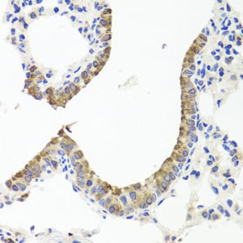 IHC-plus™ TTR / Transthyretin Antibody
