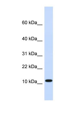 Polyclonal Rabbit anti-Human HMGN1 / HMG14 Antibody (C-Terminus, IHC, WB)