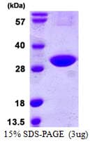 Human CINP Protein (Recombinant His)