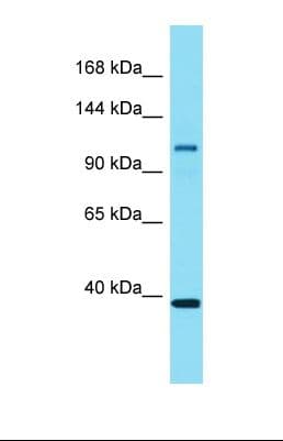 EPS15L1 / EPS15R Antibody (aa655-704)