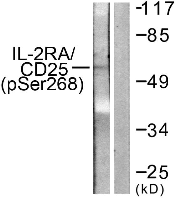 IL2RA / CD25 Antibody (phospho-Ser268)