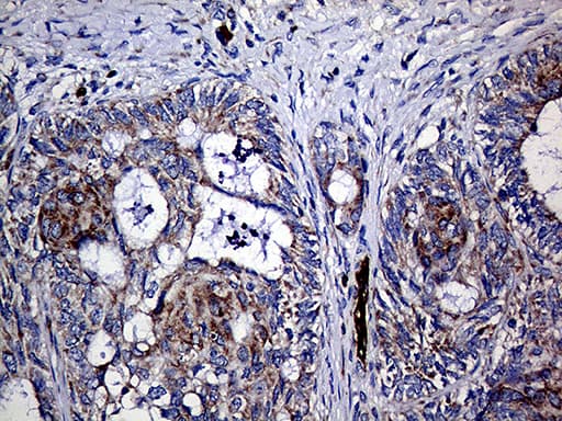 TGM2 / Transglutaminase 2 Antibody (clone OTI4H5, Carrier-free)