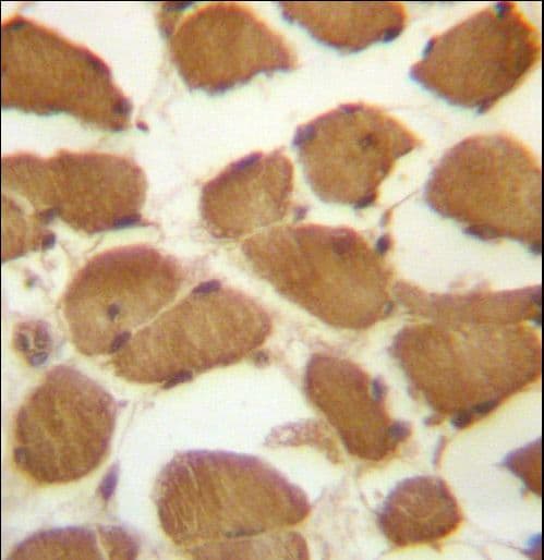 Polyclonal Rabbit anti-Human CDKN1B / p27 Kip1 Antibody (aa147-176, IHC, WB)