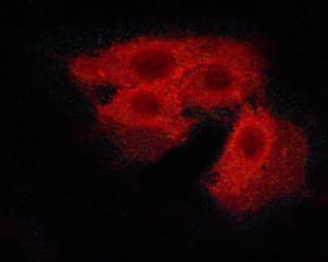 CASR/Calcium Sensing Receptor Antibody (phospho-Thr888)