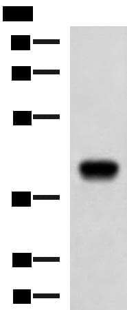 FCRLA Antibody