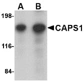 IHC-plus™ Polyclonal Rabbit anti-Human CADPS Antibody (IHC, IF, WB)