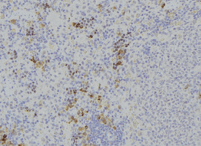 DPP4 / CD26 Antibody