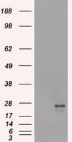 TSC501 / NAT8 Antibody (clone OTI6H3)