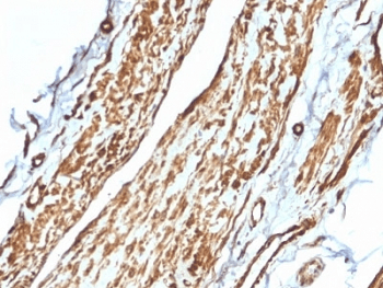 Monoclonal Mouse anti-Human VCL / Vinculin Antibody (clone VCL/2575, IHC)