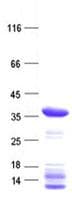 Human CDKL4 Protein (Recombinant His, N-Terminal)