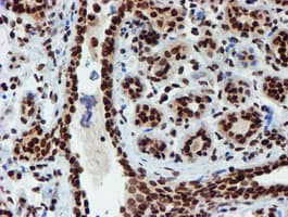 Monoclonal Mouse anti-Human PADI4 / PAD4 Antibody (clone OTI4H5, IHC, IF, WB)
