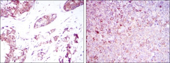 Monoclonal Mouse anti-Human BMPR2 Antibody (clone 1F12, IHC, WB)