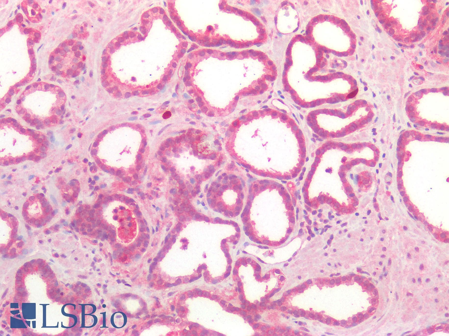 PathPlus™ Polyclonal Rabbit anti-Human CD276 / B7-H3 Antibody (IHC)