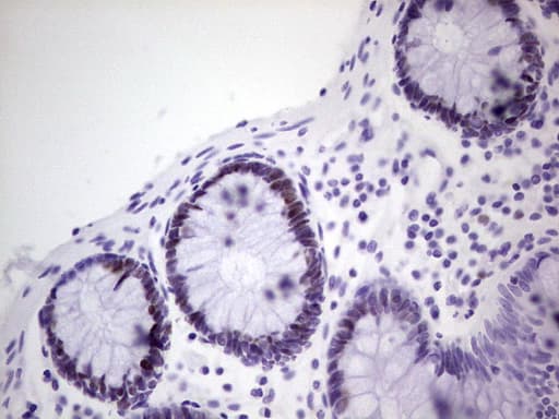 Monoclonal Mouse anti-Human MCM2 Antibody (clone OTI3B12, IHC, WB)