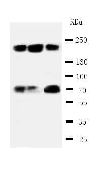 TP53BP1 / 53BP1 Antibody (aa1955-1972)