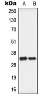 Polyclonal Rabbit anti-Human ANT2 / SLC25A5 Antibody (Internal, WB)