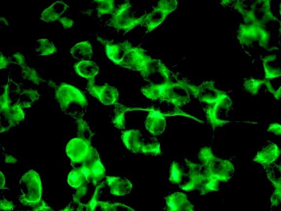 PathPlus™ NES / Nestin Antibody (clone 10C2)