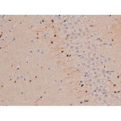 Polyclonal Rabbit anti-Human MAPT / Tau Antibody (phospho-Thr181, IHC, WB)