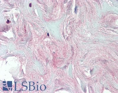 IHC-plus™ COL4A5 / Collagen IV Alpha5 Antibody
