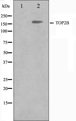 TOP2B / Topoisomerase II Beta Antibody