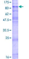 Human SLC22A2 Protein (Recombinant GST)