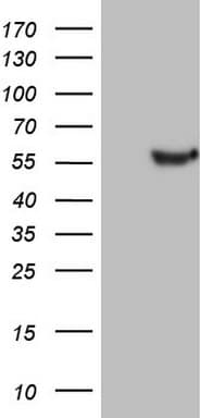 Monoclonal Mouse anti-Human LRRC6 Antibody (clone OTI1B1, WB)