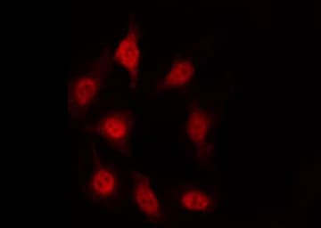 ATF1 Antibody (phospho-Ser63)