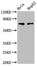 Polyclonal Rabbit anti-Human FRMD6 Antibody (IHC)