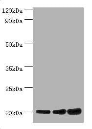NAT5 / NAA20 Antibody (aa49-178)