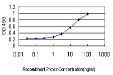 PathPlus™ Monoclonal Mouse anti-Human NDRG1 Antibody (clone 2D7, IHC, IF, WB)