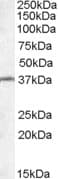 RSPH1 / TSGA2 Antibody (aa154-168)