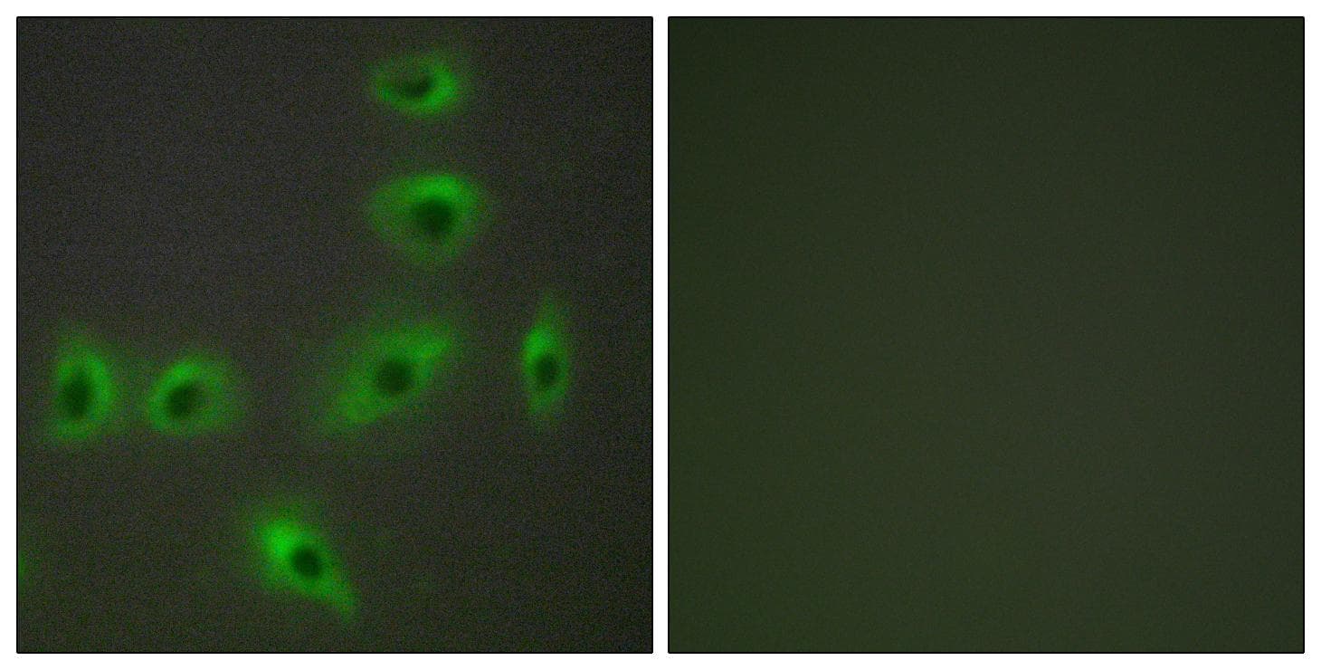 Polyclonal Rabbit anti-Human BAX Antibody (IHC, IF, WB)